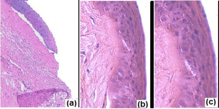 Histological cross section of excised goat cornea, stained with haematoxylin-eosin after incubation in (a) Normal saline (control); (b) N4G5; (c) isopropyl alcohol (positive control