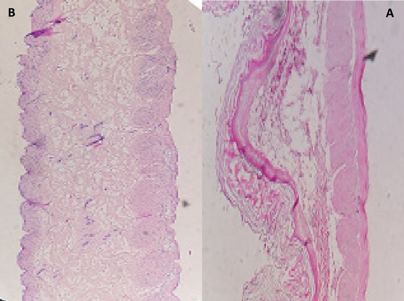 Histopathological evaluation of sections of rat gastric mucosa (A) un-treated (B) treated with microparticles discs containing MH (magnitude X).