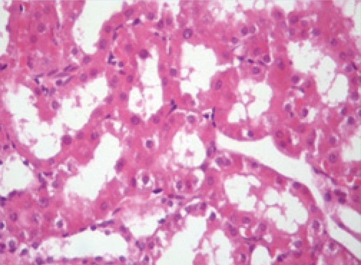 Microscopic view of the rat kidney tissue from treatment group with pantoxifylline (45 mg/Kg). Mild damage is visible in comparison with control group. (Hematoxylin-eosin staining and x40 magnification).