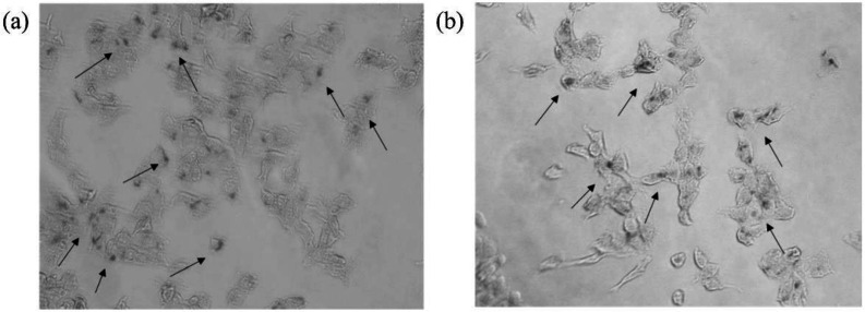 Prussian blue staining images of cells incubation with LP-PEI1800-SPION/siRNA-Luc at the weight ratio of 20 for 6 h (a) HepG2 and (b) SMMC-7721 (The arrow in the figure points to the SPION nanoparticles taken up in the cells)