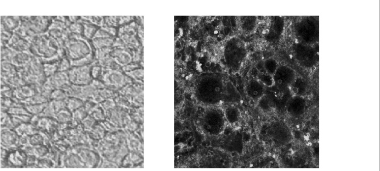 Confucian laser scanning microscopy: Interaction of 6-coumarine nanoparticles with the Caco-2 cell membrane (right), plain and intact Caco-2 cell (left).
