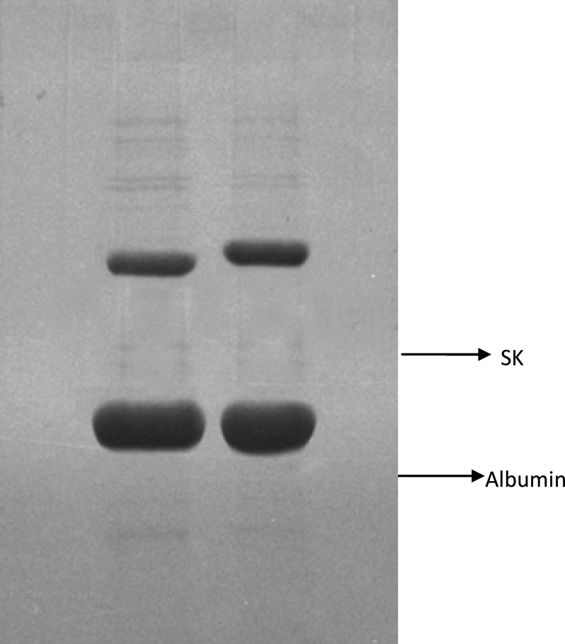 Native PAGE analysis of two streptokinase products. Lane (A) Heberkinasa® Lane (B) Streptase®.Analysis of biological activity of native and recombinant streptokinase using Clot lysis and Chromogenic substrate assay
