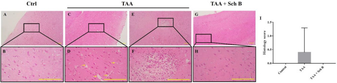 Histopathology of the brain. (A and B) Representative photomicrographs of H&E-stained brain sections from control mice. (C and F) Two representative photomicrographs of H&E-stained brain sections from TAA-intoxicated mice. (C and D) A mild increase of perivascular spaces was seen (yellow arrows). (E and F) One marked area of perivascular infiltration of macrophages and neutrophils was seen in one of the five sections. (G and H) Brain sections from Sch B treated mice. No specific pathological changes. Images are shown at 40× and 100× magnifications; scale bars, 200 μm. (I) Histology score of brain sections, presented as mean ± SD (n = 5).