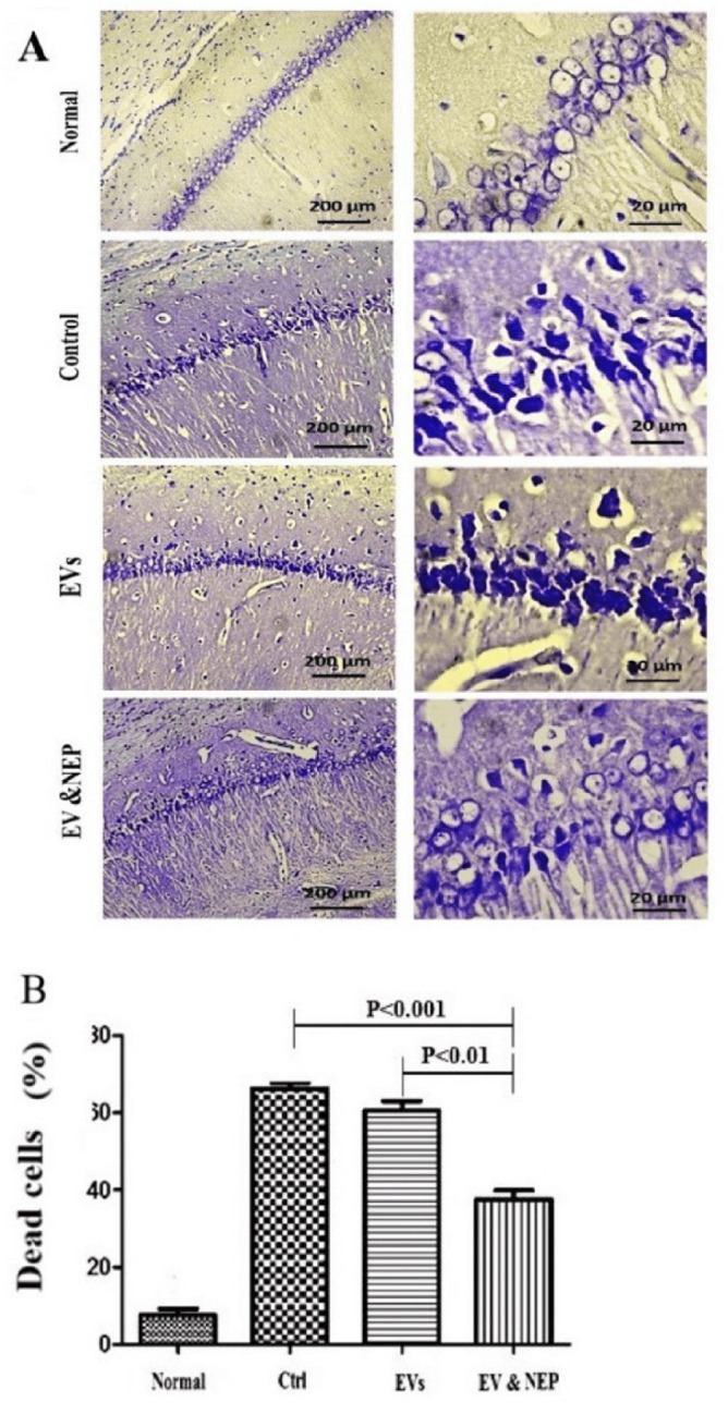The effect of intranasal EV-loaded NEP administration on hippocampus neuronal damage. (A) Representative micrographs of Nissl stained sections resulted in Normal, Control, EVs, and EV-loaded NEP groups, Scale bars: 200μm and 20μm and (B) percentage of dead cells, indicated significantly decrement in CA1 neuronal cell death count in EV-loaded NEP delivered rat brains compared to control (p < 0.001) and EVs (p < 0.01) groups after 14 days treatment; (n = 4 in each group, the dead cell results were quantified with ImageJ software and the differences between groups were determined by ANOVA followed by Tukey test). Defined groups are Normal, Ctrl: received PBS, EVs: received EVs, EV&NEP: received EV-loaded NEP in the treatment period