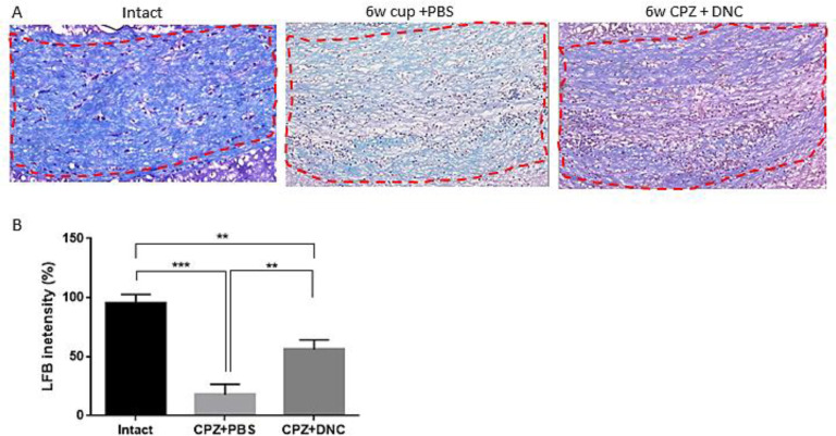DNC treatment showed protective effect on myelin content of CC during CPZ intake. (A) Representative images for LFB staining results.( B) Evaluation of myelination index by analyzing LFB intensity indicated that even though in intact mice the myelin sheets showed normal, multi-layered and compact structure 6 weeks treatment with CPZ and PBS lead to disorganized myelin composition with significantly lower intensity, compared to intact mice. But, in group that received DNC along with CPZ intake the degree of myelination was significantly higher than PBS treated group. The degree of myelin, however, was still lower in DNC group, compared to intact mice. n = 27 brain sections from 3 mice, per experiment group. Values are given as mean ± SEM as the results of ordinary one-way ANOVA followed by Tukey’s multiple comparison test