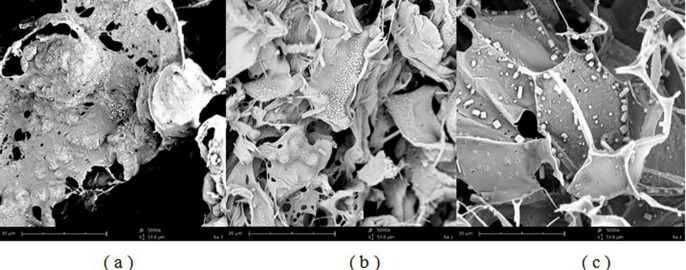 SEM images of spray freeze-dried microparticles: (a) MD1 formulation, (b) L1 formulation, (c) M1 formulation