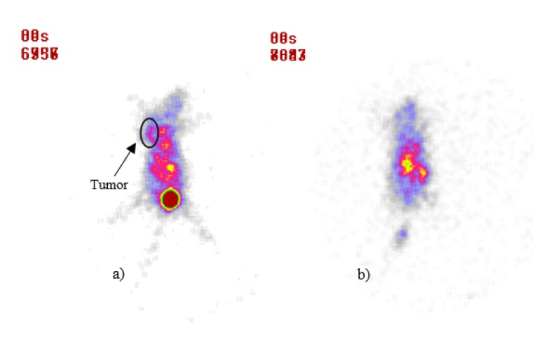 Scintigraphy image of BALB/c mice after 30 min post-injection of 99mTc-Bombesin, (a) control group, (b) treatment group after 12 d post-injection of 175Yb-PLLA microspheres