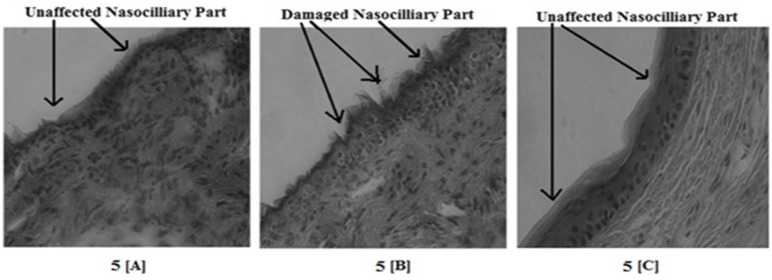 Result of nasociliotoxicity study showing the nontoxicity of developed MMEI. 5[A], 5[B] and 5[C] are representative of Saline, Propranolol and developed MMEI treated mucosal part respectively