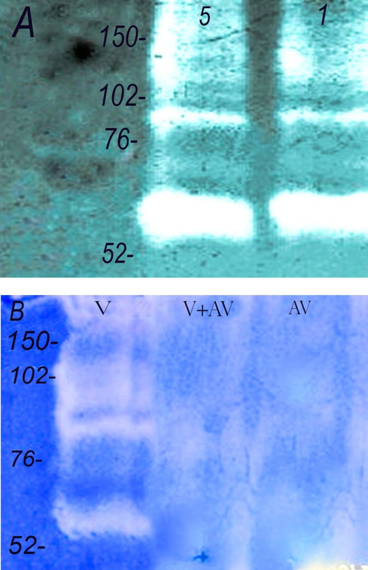 Gelatinase activity of Echis carinatus venom. Zymographic studies were performed for gelatinase activity. (A) The venom (lane 1 : 5 and lane 2 : 1 µg) was run on 12.5% containing gelatin as described in methods. (B) Neuralization of the gelatinase activity. (lane 1: venom alone, 1 µg, lane 2: venom 1 µg + antivenom, 5µL and lane 3: antivenom, 5 µL). Numbers on the left indicate the molecular weight of size markers