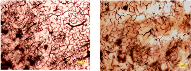Photomicrographs of the hippocampus stained by Golgi staining. (A) Normal and (B) Meth groups; the total length of dendrites was also decreased in Meth groups in comparison with the Normal groups