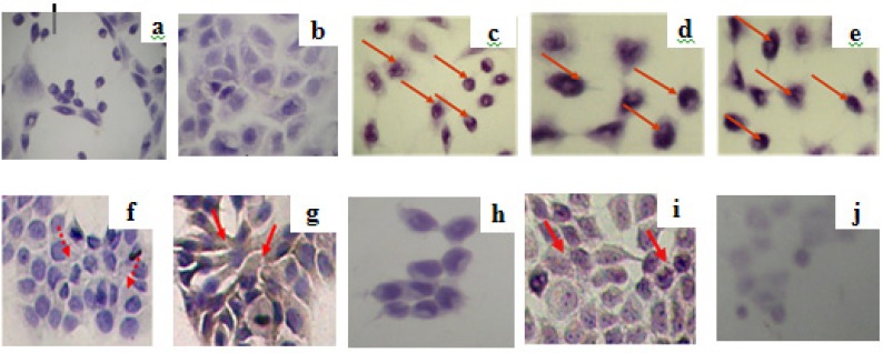 Imunocytochemistry assay of expression of apoptosis regulator proteins p53 (a-e) and Bcl-2 (f-j) by using combination of ethanolic CPE with doxorubicin in MCF-7 cell line. MCF-7 cells (5 x 104 cells/well) were seeded on coverslips in 24-well plates until confluent. Than, plate was incubated with samples for 15 hours. Futhermore, imunocytochemistry was done. Protein expression observed by light microscope; (a,f) control without antibody; (b,g) control with antibodi, (c,h) CPE, (d,i) doxorubicin 200 nM, dan (e,j) doxorubicin 200 nM-CPE 6 μg/mL. Protein expression was pointed by red arrow