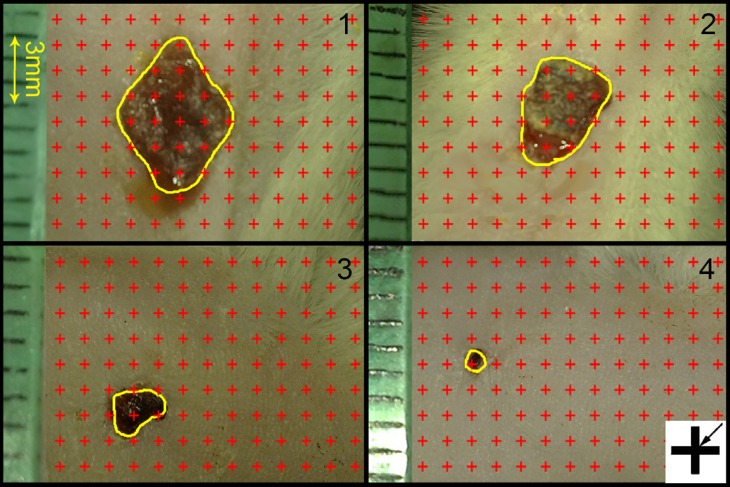 Digital photographs were captured from the wound surfaces every four days to measure the wound area. The total number of points within the wound borders (yellow line) was counted. As it is shown at the corner of this Figure, the right upper corner of the cross is considered as the point (arrow), and it is counted only if the right upper corner hits the wound surface. (1): day 1, (2): day 4; (3) day 8; (4) day 12 of Simvastatin-treated group