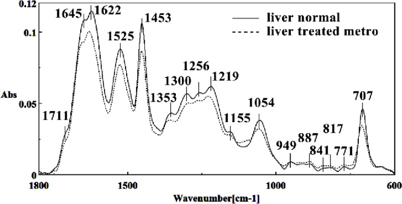 Mid-infrared spectra of normal (solid line) and Metronidazole treated (dot line) liver sections in the 600–1800 cm–1 wave number region