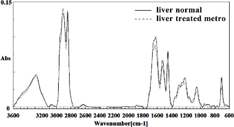Mid-infrared spectra of normal (solid line) and Metronidazole treated (dot line) liver sections in the 600–3600 cm–1 wave number region