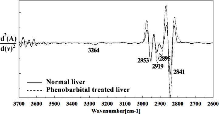 Second derivative of mean FTIR spectra of normal (solid line) and Phenobarbital treated (dot line) liver sections in the 3700–2600 cm-1 wave number region. The spectra are baseline-corrected and normalized.