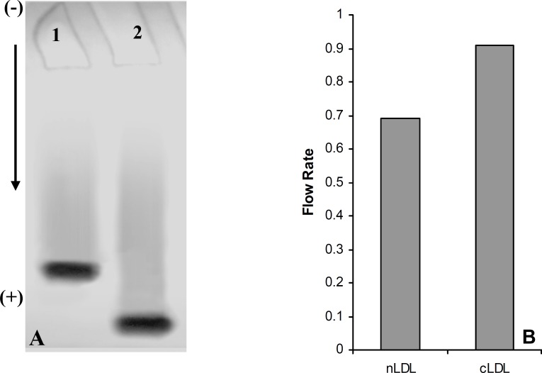 (A) Electrophoresis analysis of native LDL (Lane 1) and carbamylated LDL (Lane 2) on 5% polyacrylamide gel. (B) Comparison of the flow rate of native LDL (nLDL) with carbamylated LDL (cLDL) on 5% polyacrylamide gel