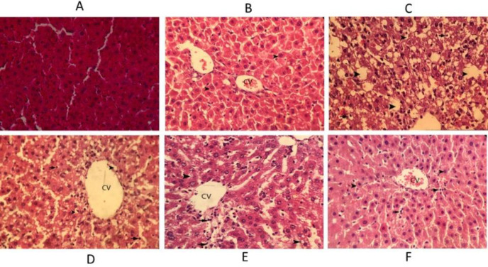 Hematoxylin–eosin staining of liver sections in rats. (A) Liver section in the normal rat. (B) Silymarin treated rats (C) CCl4-intoxicated rats, (D) Extract (75 mg/kg) treated rats, (E) Extract (150 mg/kg) treated rats, (F) Extract (300 mg/kg) treated rats, Arrows indicate hepatocyte degeneration, necrosis, and inflammatory cells infiltration, etc. Original magnification ×400. CV denotes central vein