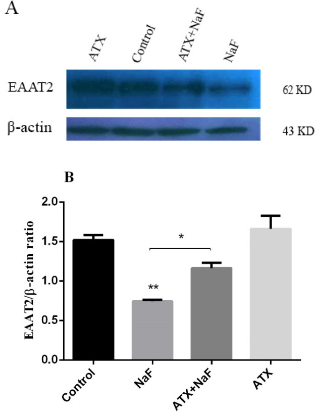 Effect of NaF exposure and ATX pretreatment on EAAT2 protein expression. (A) Western blot analysis of groups with exposure to 0.2 mM NaF alone (NaF) and after pretreatment with 30 μM ATX (ATX+NaF) was carried out after 24 h. Control and ATX groups were treated without NaF/ATX and with ATX alone, respectively. β-actin was used as a cell house-keeping protein. (B) The expression of EAAT2 was semi-quantitated as a ratio to β-actin