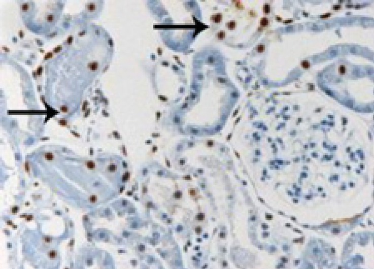 Microscopic view of the rat kidney tissue from control group that ischemia-reperfusion has been applied to them. Pay attention to the TUNEL-positive or apoptotic cells (arrows). (40×magnification).
