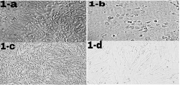 Morphological changes of ICD-85 on MCF-7 and HDF cells. MCF-7 and HDF cells (1 × 104 cells/well) were cultured in RPMI-1640 and DMEM medium respectively supplemented with 10% heat inactivated fetal bovine serum and treated in the absence (control cells) or presence of ICD-85 at 80 μg/mL for 24 h at 37 °C. Morphological changes of treated cells were observed with an invert microscope and compared with control cells. Figure 1b (20X) shows granulation and cell rounding in MCF-7 cells treated with ICD-85 as compared to untreated MCF-7 cells (1-a, 20X). There are no significant morphological changes in HDF normal cells treated with ICD- 85 (1-d, 20X) as compared to untreated HDF cells (1-c, 20X)