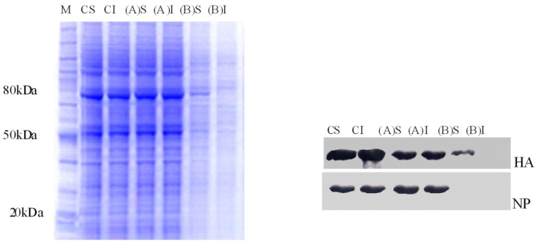Triton X-100 solubilization analysis of A549cells infected with H9N2influenza virus in pre- and post treatments of Sambucus nigra (EF). Equivalent aliquots from soluble material (S) and insoluble (I) fractions of 80 mg/mL of EF in trials (A) and (B) were subjected to SDS-PAGE. Then viral HA and NP were detected by Western blot using specific antibodies. HA incorporated into lipid raft during virus attachment to the cell membrane. In post treatment with the higher dose of EF, the solubility of HA was affected due to the disruption of lipid raft, whereas the solubility of the protein remained unaffected in control (C). The NP floated to the top fraction in (A) treatment