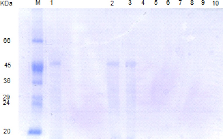 SDS-PAGE patterns of L. acidophilus ATCC4356 S-layer protein digested by SGF (pH 2, without pepsin). M: molecular weight marker, Lane 1: Native S-layer protein, lanes 2- 10: SGF digestion pattern of S-layer protein at time = 0, 5, 10, 15, 30,45,60,90,120 min.