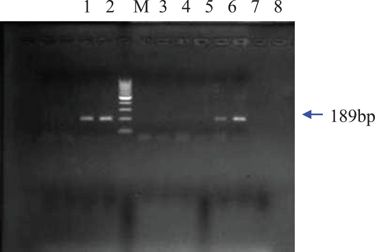 Agarose gel electrophoresis of PCR products from DNA of 3 food samples containing Bt-11.