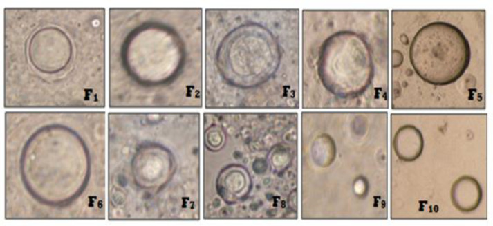 Phase Contrast Photomicrographs of Ibuprofen loaded niosomes formulations (F1-F10).