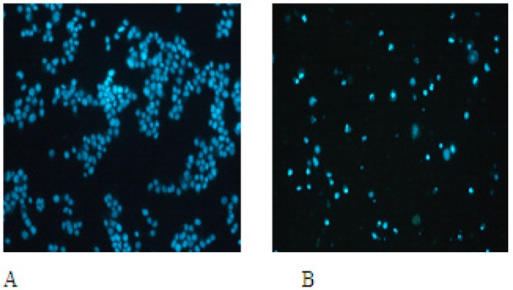 EN-induced apoptotic morphological changes. MCF-7 cells were incubated in the medium alone for 48 h (A) or in the medium containing 40  M EN for 48 h (B).