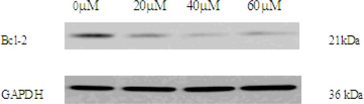 The expression of Bcl-2 in 0, 20, 40, 60 μM EN-treated MCF-7 cells. The cells were treated with EN for 48 h. Bcl-2 were analysed by western blot. GAPDH was used as an equal loading control