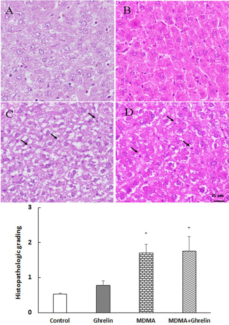 Histological sections of the rat liver from (A) control, (B) ghrelin (10 nmol/kg, i.p. with 3 h apart) injected animals, (C) MDMA (20 mg/kg, i.p.) injected animals and (D) MDMA in combination with ghrelin at the same dosage exposure animals were stained with Hematoxylin and Eosin stain. Magnification 400x. The histological changes were scored according to the following criteria: 0, absent; 1, mild; 2, moderate; and 3, severe hepatocellular necrosis. Statistical comparison between groups was performed using analysis of variance followed by the Tukey test. *p < 0.05 as compared to control group