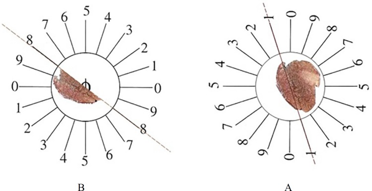 The orientator method to obtain the isotropic uniform random (IUR) sections. (A) The whole pancreas was placed on the one circle and a random number choose randomly. Then the pancreas was cut at that direction (here, it was 1). (B) Then, the other part of pancreas was located in the other circle and the second cut at a random number (here, it was 8).