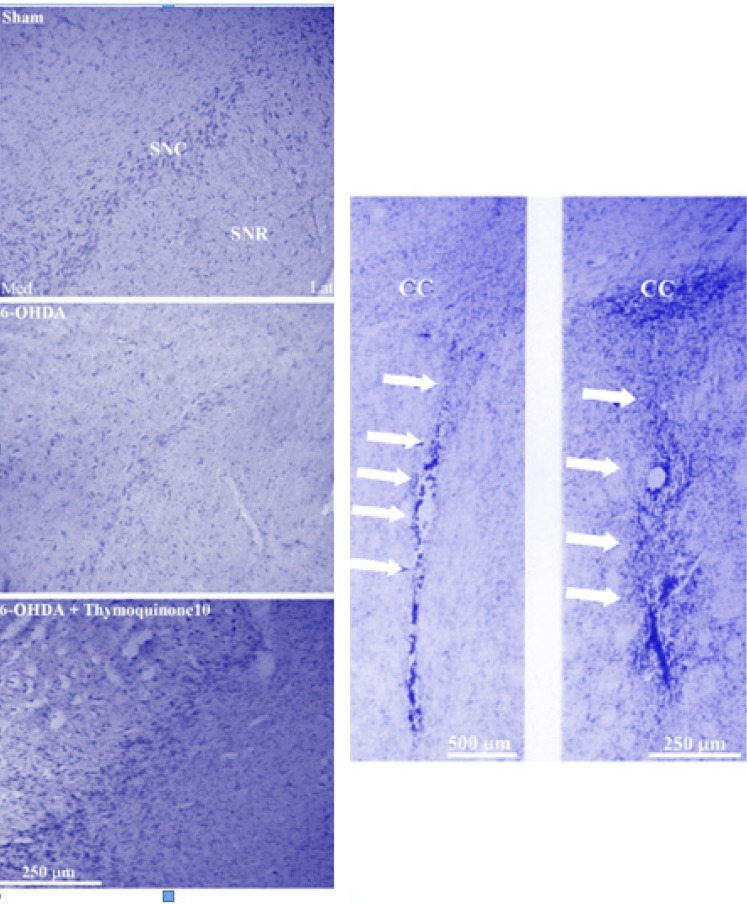 Photomicrograph of coronal sections through the midbrain showing Nissl-stained neurons in experimental groups (left panels) and injection site at low- and high-power magnifications in neostriatum (right panel). A severe reduction in the number of neurons in SNC was observed in the 6-OHDA lesioned group, but no such marked reduction was noted in the thymoquinone 10-treated lesioned group in comparison with Sham group. Scale bar = 250 μm (SNC and SNR = Substantia nigra pars compacta and pars reticulata respectively; CC=corpus callosum).