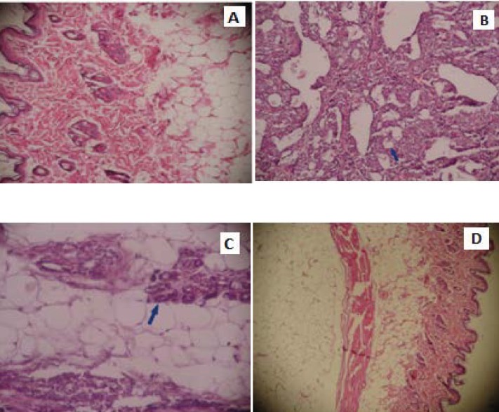 Histopathological examination of breast tissue in control group and experimental
groups. The tissue of untreated rat (A) (HEx200), The breast tissue of the rat induced
with the NMU (B) (HEx200), The breast tissue of the rat fed with UD, induced with the
NMU (C) (HEx200), The breast tissue of the rat fed with UD (D) (HEx200