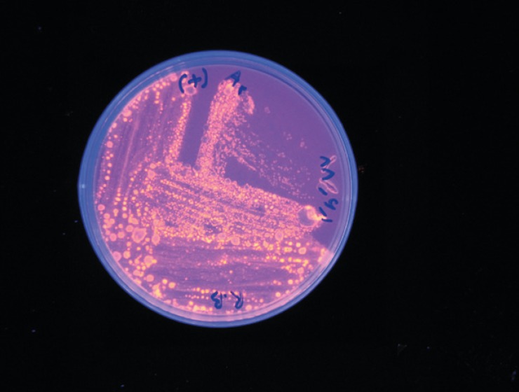 large colonies from lecitinase medium were transferred to Rhodamine B medium. Colonies with a clear halo in 302 nm wavelength were selected in this medium