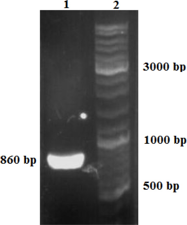 Confirmation of correct insertion in the genome in transfected cells Lane 1 PCR product of insulin gene and rRNA. Lane 2: I kb DNA ladder marker