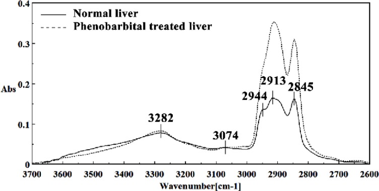 Mid-infrared spectra of normal (solid line) and phenobarbital treated (dot line) liver sections in the 3700–2600 cm-1 wave number region. The spectra are baseline-corrected and normalized.