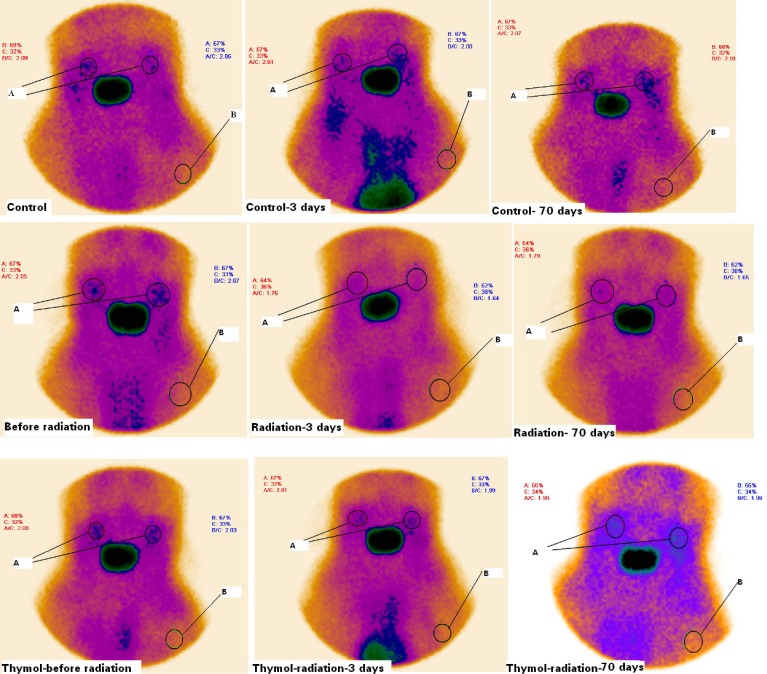Scintigraphy of salivary glands of rats treated with thymol (50 mg/Kg) and/ or radiation on the before and 3th and 70th days after irradiation. Rats were treated with oil or thymol and then irradiated with gamma irradiation at dose of 15 Gy. A significant reduction in salivary glands uptake of radioactive was observed in irradiated rats as compared with control and thymol groups. A: salivary glands (T), B: background (B). T/B ratios were calculated with respect to radioactivity accumulation in salivary glands and background