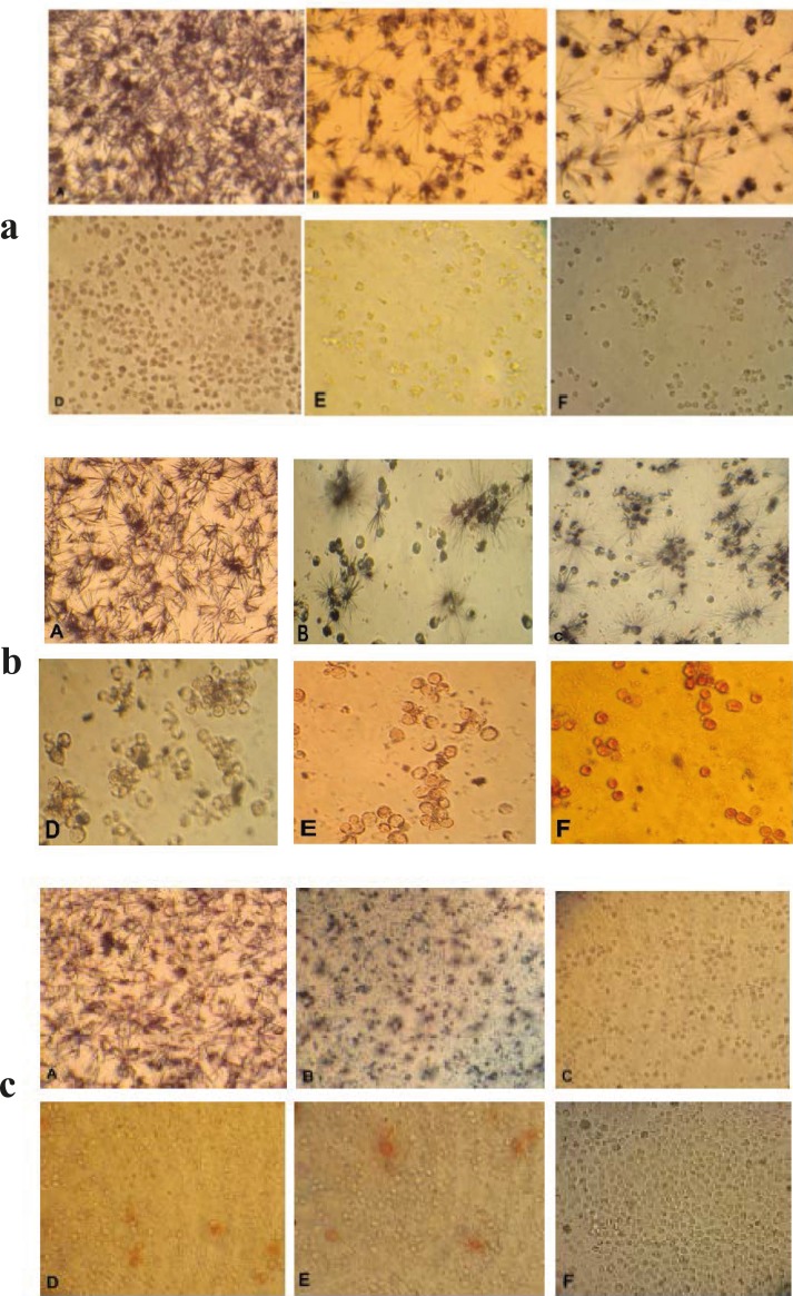 Morphological effect control groups and groups treated with concentrations of 15, 31, 62, 125, 250 µg/ml brittle star dichloromethane extract O. erinaceus (a) and doxorubicin (b) 24 h after treatment observed by inverted microscope (magnification × 200) A: control, B: 15 µg/ml, C: 31 µg/ml, D: 62 µg/ml, E: 125 µg/ml, F: 250 µg/ml. c) Morphological changes under treatment with co-administration of brittle star dichloromethane extracts and doxorubicin after 24 h treatment. A: control group, B: 7.5 µg/ml DCM and 7.5 µg/ml doxorubicin (IC50) C: 31 µg/ml DCM and 7.5 µg/ml doxorubicin D: 7.5 µg/ml DCM and 31 µg/ml doxorubicin E: 15 µg/ml DCM and 31 µg/ml doxorubicin F: 31 µg/ml DCM and 15 µg/ml doxorubicin. (Magnification × 200).