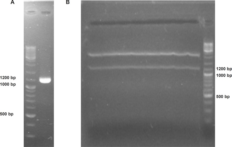 Confirmation of soluble human TRAIL cloning into 35S-TR plasmid using electrophoresis on 2% Agarose gel. Panel (A) represents obtaining a 1209 bp “35S promoter-TR inserted-CaMV polyA fragment” via PCR. Panel (B) demonstrate separation of cloned 1200 bp TRAIL expressional region from 35S-TR plasmid through EcoRV digestion.
