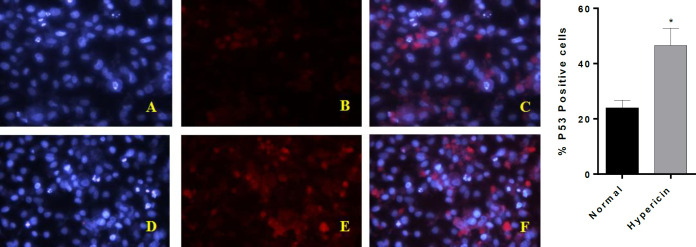 ICC-test for p53 protein. (A-C) are AGS untreated cells, (D-F) are AGS cells which treated with IC50 dose of Hypericin for 24 h. (A and D) are cells nuclei that stained with DAPI. B and E stained with anti p53 antibody-secondary antibody-FITC (C) is the merged picture of (A and B), F is the merged picture of (D and E). The diagram demonstrates quantification of p53 positive cells (p-value = 0.0447). After treatment of AGS cells, red dots increased (E and F); which demonstrates about twofold p53 upregulation at the protein level