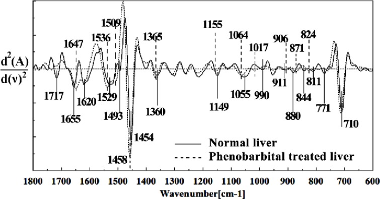 Second derivative of mean FTIR spectra of normal (solid line) and Phenobarbital treated (dot line) liver sections in the 1800–600 cm-1 wave number region. The spectra are baseline-corrected and normalized.