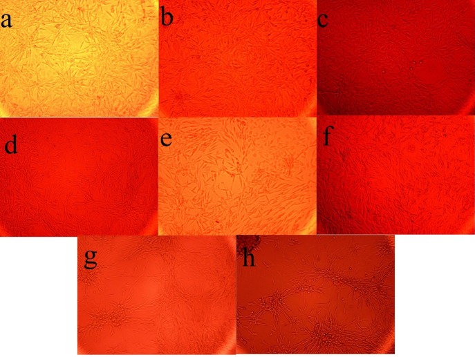 The Effect of the fermentation broth extract (FBE) of Kribbella sp. UTMC 267 on the size and the number of calciﬁcation nodules in vascular smooth muscle cells (A7r5). All cells were incubated in the presence of β-glycerophosphate + CaCl2. (a-f) FBE fractions (I-A, I-B, I -C, 1-D, I and II), (g) un-inoculated culture medium extract, (h) no extract was added