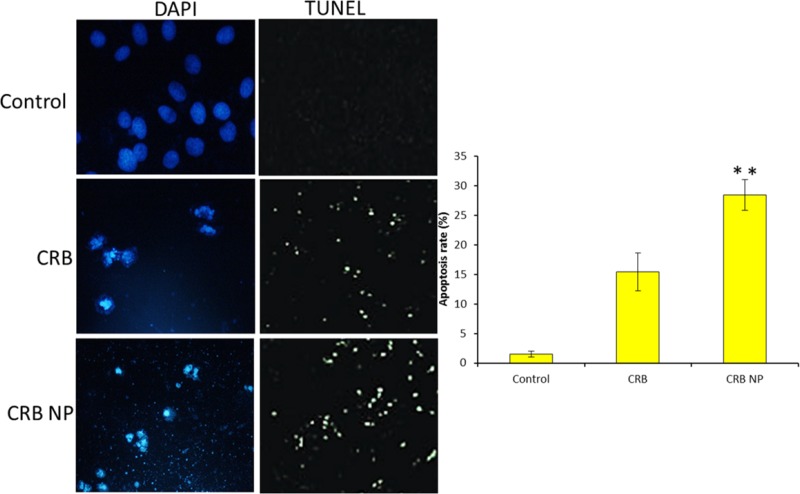 In-vitro antitumor efficacy of free CRB and CRB NP was evaluated by means of (a) Hoeschst staining and (b) TUNEL assay. The blue fluorescence in the cells indicates the Hoeschst staining and for TUNEL assay, green fluorescence was observed from the nucleus