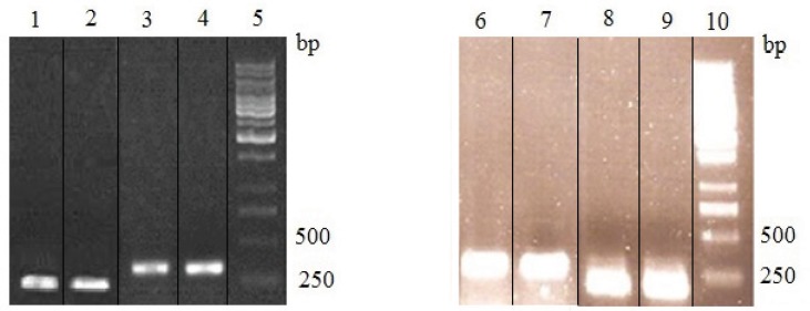 RT-PCR analysis of PDI mRNA in cysteamine treated rSp2.0. Lane 1, amplification of PDI gene from RNA of control cells; lane 2, amplification of PDI gene from RNA of treated cells by 2 mM cysteamine; lane 3, amplification of β-actin gene from RNA of control cells; lane 4, amplification of β-actin gene from RNA of treated cells by 2 mM cysteamine; lane 6, amplification of β-actin gene from RNA of control cells; lane 7, amplification of β-actin gene from RNA of treated cells by 4 mM cysteamine; lane 8, amplification of PDI gene from RNA of control cells; lane 9, amplification of PDI gene from RNA of treated cells by 4 mM cysteamine and lanes 5,10, 1kb DNA ladder. Cysteamine was added to culture medium. After 24 h, cells were harvested and total RNA was isolated from rSp2.0 cells. Levels of mRNA were standardized by β-actin mRNA. The expected size of products was 186 bp for PDI and 318 for β-actin. The experiments were repeated three times independently.