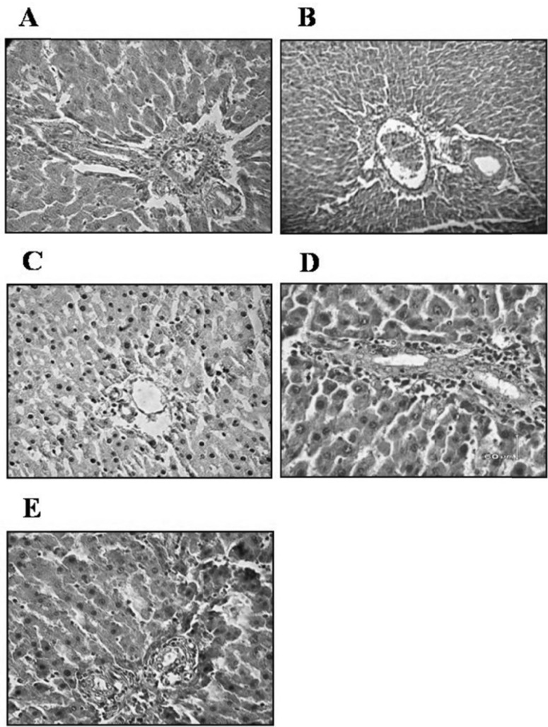 Effect of oral administration of garlic juice on the histophatological changes of the liver plates and the portal triad size. In D group, focal liver cells disruption was obvious and portal triad, to some extent, showed a decrease in volume and size. N group (A), N+G group (B), D group (C), D+Gb group (D), and D+Ga group (E). The original magnification: ×40, Scale bars=60 μm, H&E staining. (N=Normal, N+G=Normal+Garlic, D=Diabetic, D+Gb=Diabetic+Garlic-before, D+Ga=Diabetic+Garlic-after
