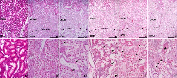 Effect of Dendrobium nobile Lindl extracts (DNE) on the cisplatin-treated rat kidney. H&E staining was used to assess tissue damage. (A) Control; (B) cisplatin alone; (C) captopril (100 mg/kg) pretreatment; (D) DNE (100 mg/kg) pretreatment; (E) DNE (300 mg/kg) pretreatment; (F) DNE (500 mg/kg) pretreatment group. All rats given orally each compound for 28 days. On day 23, cisplatin (5 mg/kg) was injected intraperitoneally to induce acute kidney injury. Tubular epithelial cells remained in the proximal tubules (arrows) in the S3 segments of proximal tubules of the outer stripe of the outer medulla (OSOM). The proximal tubules showed almost normal morphology (stars). Bar; 200 μm (A-F), 100 μm (A`-F`).