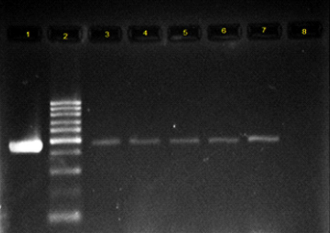 Electrophoresis of PCR product on 1.5% agarose gel for Int1 gene. Lane 1: positive control for Int1 gene; Lane 2: 100 bp DNA ladder as the molecular size marker; Lane 3-7: the Int1 gene detected in UPEC strains; Lane 8: PCR mix with no template (negative control).