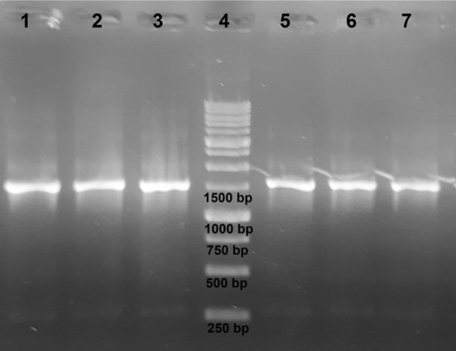 Agarose gel electrophoresis of PCR products. Extracted genomic DNA samples were amplified using 16S rDNA gene-specific primers. From left to right: E. coli, S. epidermidis, S. aureus, DNA ladder, B. licheniformis, Y. enterocolitica, P. aeruginosa