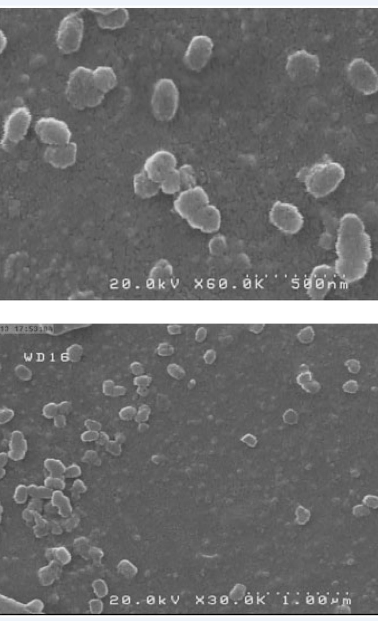 Scanning electron micrographs of 18-β-glycyrrhetinic acid (GLA) loaded poly (lactide-co-glycolide) (PLGA) nanoparticles with different magnifications.